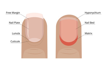 Nail anatomy showing free margin, nail plate, lunula, cuticle, hyponychium, nail bed and matrix