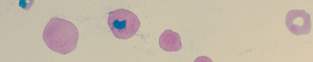 Illustrations Dots. Yellow Polka Flower. Grey