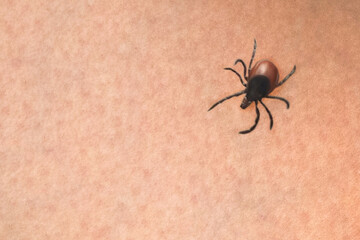 Tick on the skin, close up photo