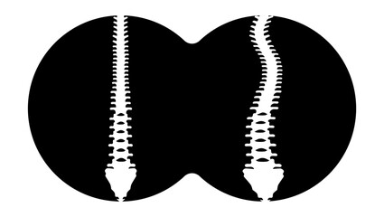 scoliosis symbol, black isolated silhouette