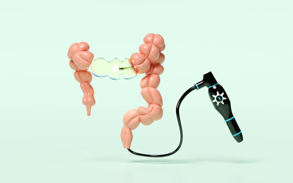 Colonoscopy to find the cause of disease isolated on green background. check digestive, intestine health concept, 3d illustration render