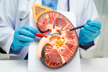 Chronic kidney disease, doctor with model for treatment urinary system, urology, Estimated...
