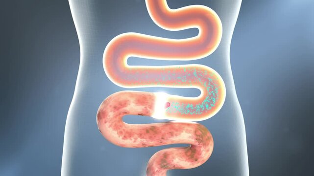 Probiotics promote intestinal peristalsis, activate intestinal motility, promote digestion, and eliminate toxins. Clean up stool, intestinal and digestive system health concept, 3D animation.