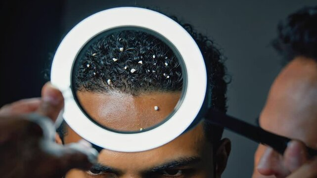 Magnifying glass looking at hair dandruff.