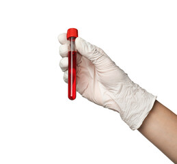 Doctor in medical glove holding test tube with blood sample on white background, closeup