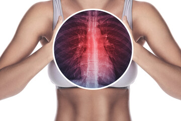 Woman Experiencing Chest Pain with Highlighted Lungs and Ribcage