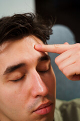 Young guy sticking acne patches to forehead to clean skin from zits. Using acne patches for facial skincare.