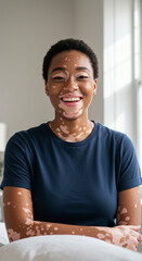 Woman with white spots on her face and vitiligo