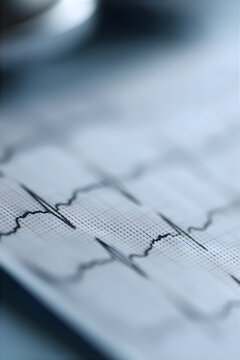 Vital Rhythms. Electrocardiogram Recording Cardiac Activity. Macro photograph of an electrocardiogram printout showing the distinctive red waveform pattern of heart electrical activity against gridded