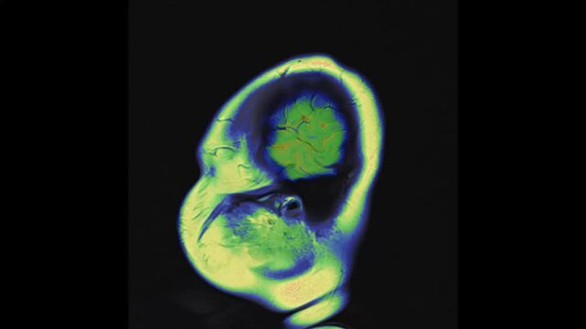 normal brain MRI 