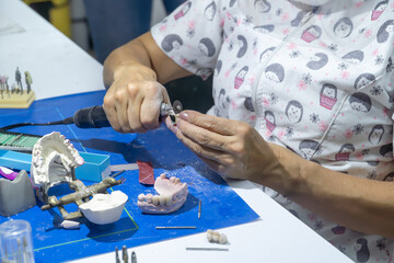 Dental technician make denture prothesis with motor tool in dental laboratory. Hands of dental technician make denture prothesis