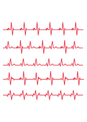 Electrocardiogram Set of materials to illustrate the line rhythm