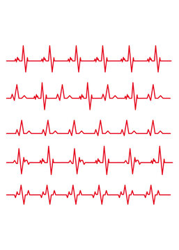 Electrocardiogram Set of materials to illustrate the line rhythm