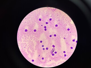 The slide shows a large number of white blood cells, appearing as round or irregularly shaped cells...