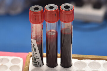 A high-resolution image of empty blood collection tubes arranged in a clinical or laboratory setting. These sterile, transparent tubes are designed to safely collect and store blood samples for medica