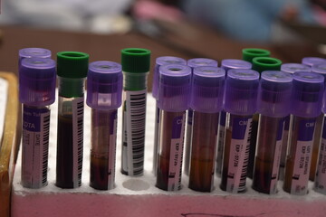 A high-resolution image of empty blood collection tubes arranged in a clinical or laboratory setting. These sterile, transparent tubes are designed to safely collect and store blood samples for medica