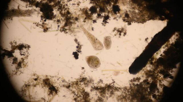 Stentor, sometimes called trumpet animalcules, are a genus of filter-feeding, heterotrophic ciliates, representative of the heterotrichs in waste water under the microscope.