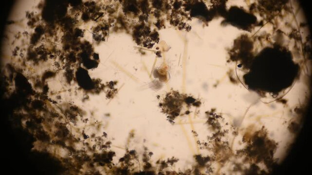 the movement of the infusorian Trichodina, which is a commensal, and is often absorbed into fish and hydras, under a microscope