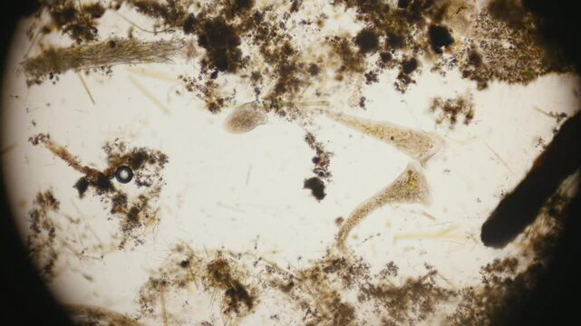 Stentor, sometimes called trumpet animalcules, are a genus of filter-feeding, heterotrophic ciliates, representative of the heterotrichs in waste water under the microscope.