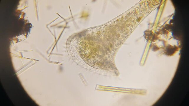Stentor, sometimes called trumpet animalcules, are a genus of filter-feeding, heterotrophic ciliates, representative of the heterotrichs in waste water under the microscope.