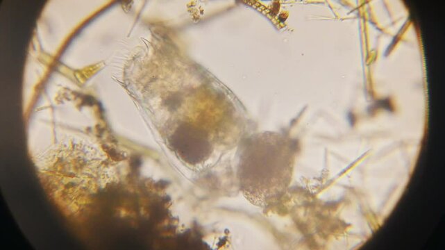 Stentor, sometimes called trumpet animalcules, are a genus of filter-feeding, heterotrophic ciliates, representative of the heterotrichs in waste water under the microscope.