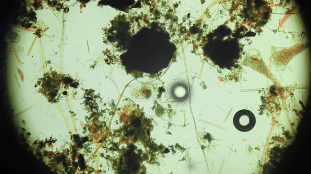 Stentor, sometimes called trumpet animalcules, are a genus of filter-feeding, heterotrophic ciliates, representative of the heterotrichs in waste water under the microscope.