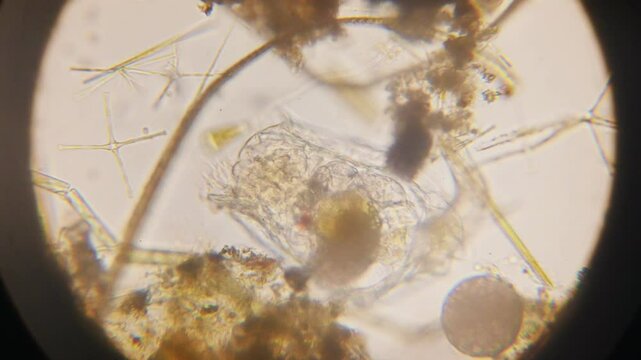 Stentor, sometimes called trumpet animalcules, are a genus of filter-feeding, heterotrophic ciliates, representative of the heterotrichs in waste water under the microscope.