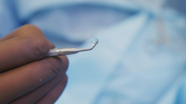 Surgeon's gloved hand holding intraocular lens with forceps, close-up shot
