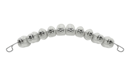 Isolated Dental Braces