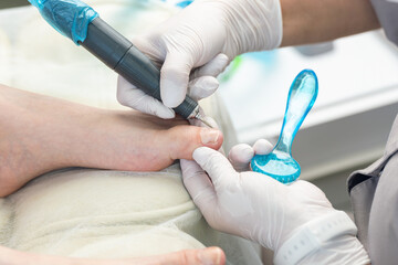Professional hardware pedicurist, podiatrist cleaning nails using a nail miller