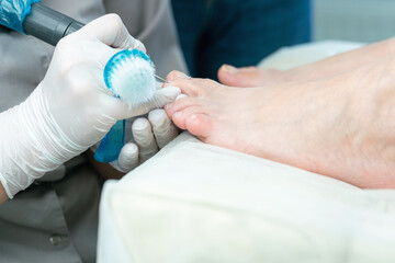 Professional hardware pedicurist, podiatrist cleaning nails using a nail miller