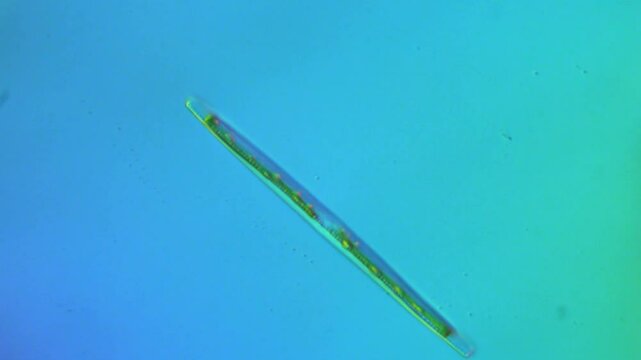 Elongated Diatom in freshwater glides - 400x DIC microscope