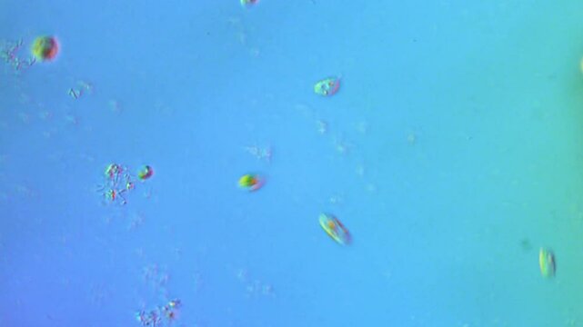 Freshwater Algae and Ciliates - 400x DIC Microscope