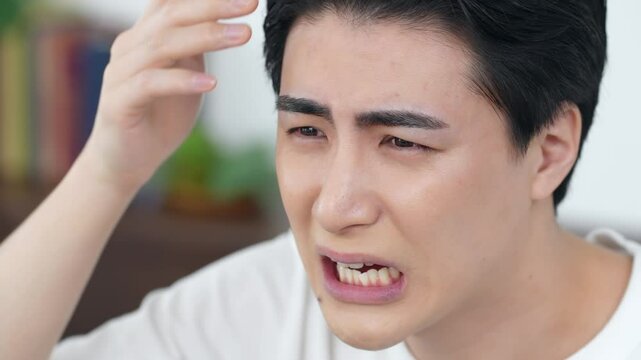 生え際とおでこニキビを気にする男性