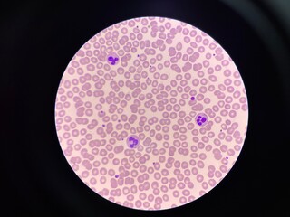 Normal red blood cell.