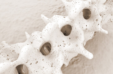 Osteoporosis - spine - isometric view 3d illustration