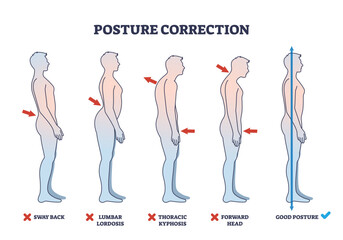 Posture correction diagram shows five side-view silhouettes illustrating various spine alignments. Key objects, silhouettes, arrows, spine. Outline diagram