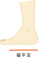 偏平足のイラスト