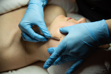 Woman getting dermaplane facial at spa