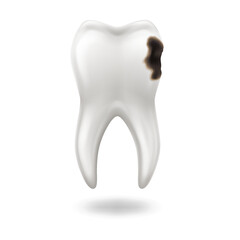 Realistic illustration of a tooth showing dental decay, white background, highlighting dental health issues. Educational and medical uses with emphasis on oral hygiene awareness.