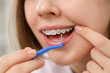 Young woman with dental braces cleaning teeth at home, closeup