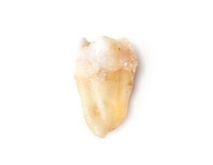 Isolated wisdom tooth after extraction. Real hole wisdom tooth or third molar with visible root and crown. Dental healthcare or clinical anatomy reference. Selective focus.