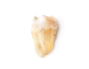Isolated wisdom tooth after extraction. Real hole wisdom tooth or third molar with visible root and crown. Dental healthcare or clinical anatomy reference. Selective focus.