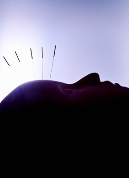 accupuncture, aura, meditation, needle, peaceful, headache, laying down, purple.