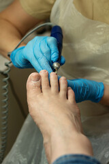 Podiatry specialist using rotary file on toenails in clinic. Chiropody and podology concept, foot...