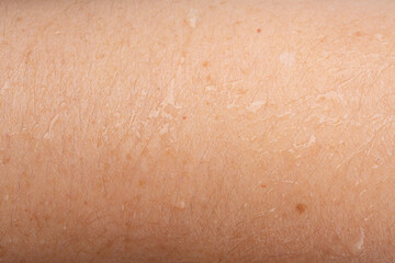 Fototapeta premium Wet human skin with water drops closeup. Sweat healthy body, macro shower drops on woman skin