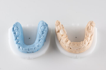 dental crown made of ceramics
