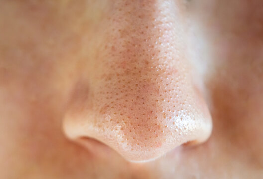 Close-up of a woman's nose with blackheads or black dots.
