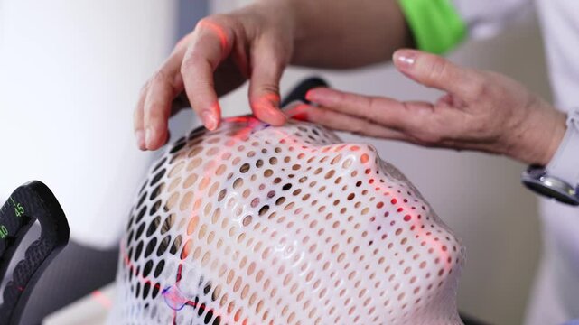 Close-up of markings attached to the immobilization mask for accurate diagnosis of the tumor location. Concept of modern advanced medical technology.