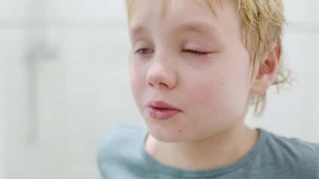 Sick boy with pus on his eyelid and red broken blood vessels in eye. Conjunctivitis, trauma of eye, inflammation, infection, allergy or intraocular pressure are reason for contacting ophthalmologist.